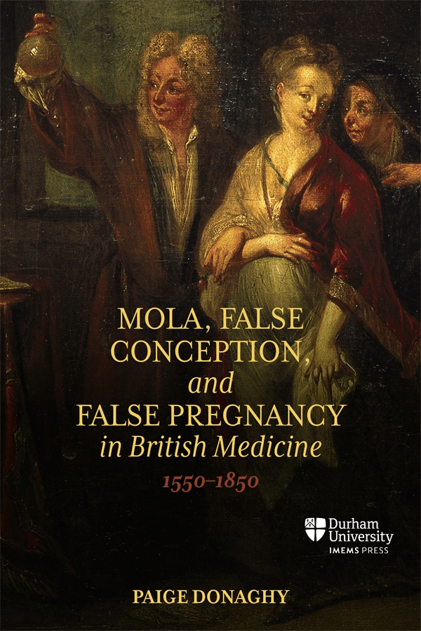 This image is the cover to Donaghy's book on False Pregnancy. It features a 17th century oil painting of a pregnant women whose urine is being tested by a physician. The pregnant woman is smiling coyly